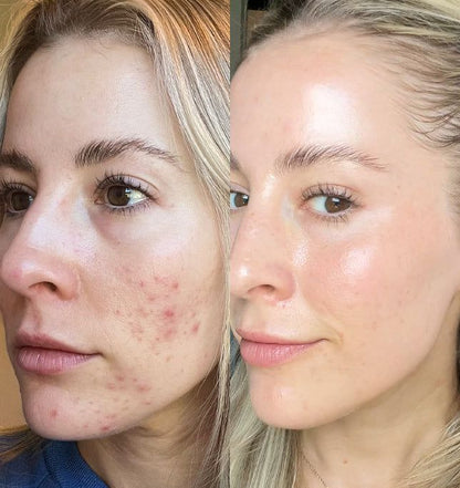 Masque Collagène Bio™